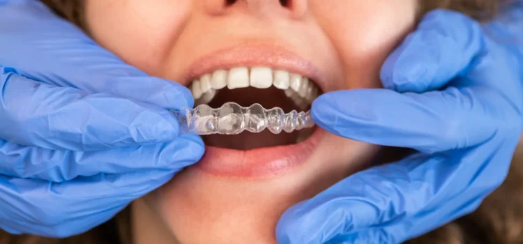 Şeffaf Plak Tedavisinde İlk Adımlar: Dijital Gülüş Tasarımının Önemi